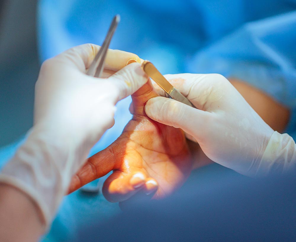 wide-awake-hand-surgery-side